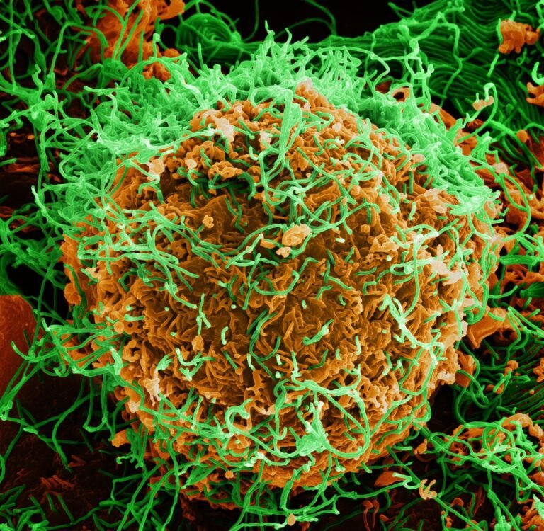 Watching Ebola Return – CounterPunch.org