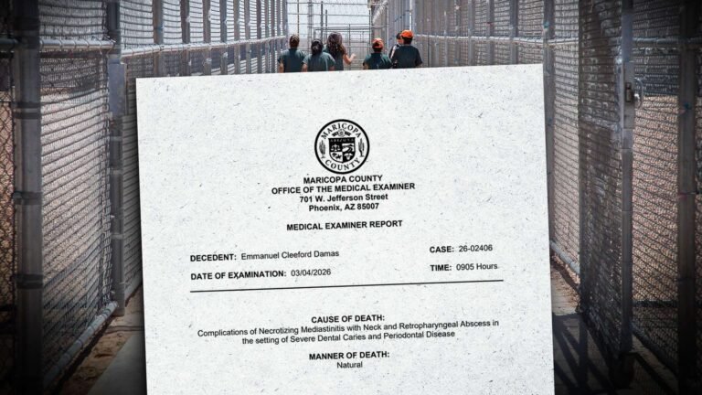 An ICE detainee died from a tooth infection, autopsy report says