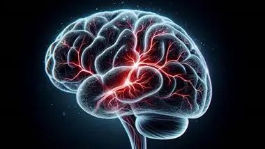 A Ministroke Has Major Consequences