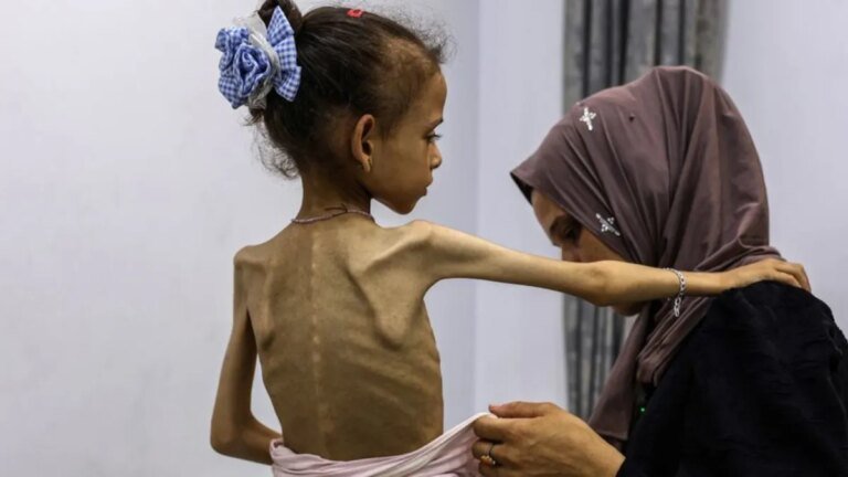 Genocide Deniers Call Gaza Starvation A ‘Hoax’ By Citing UNICEF—Which Reported Famine